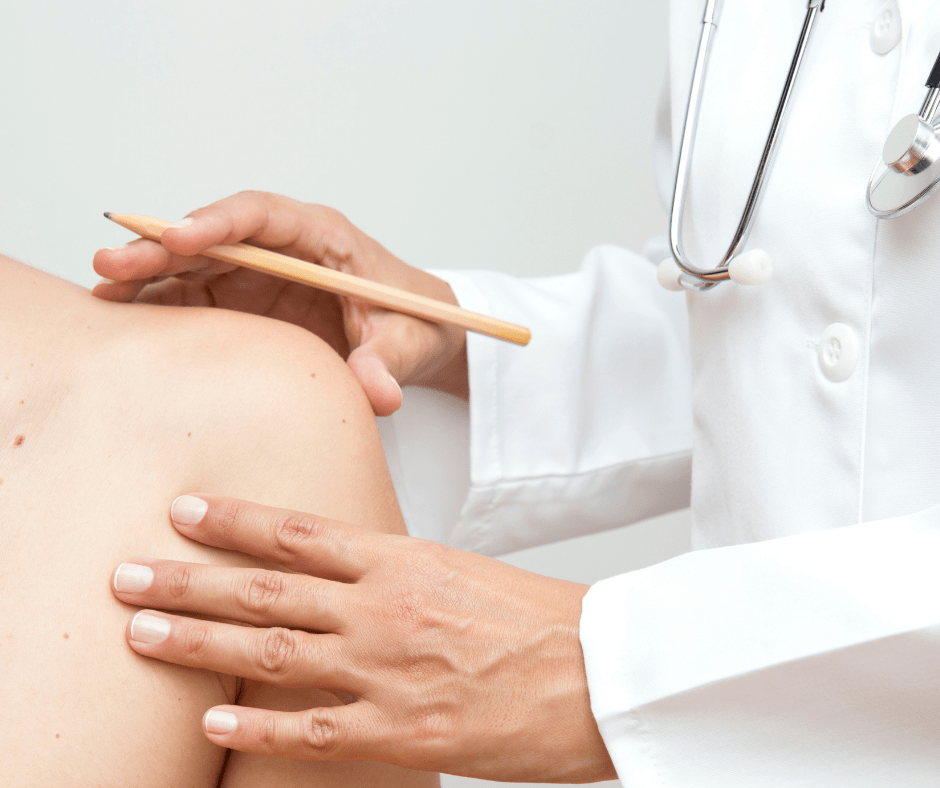 Read more about the article Càncer de pell: símptomes i factors de risc