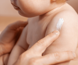 Com mantenir la pell del nadó sempre sana?