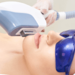 Llum polsada intensa (IPL): noves aplicacions en dermatologia