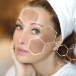 IPL facial: tractament per taques i altres afeccions de la pell