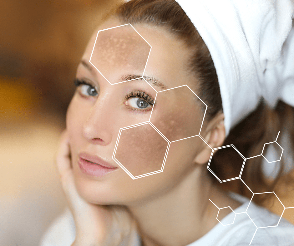 Més informació sobre l'article IPL facial: tractament per taques i altres afeccions de la pell