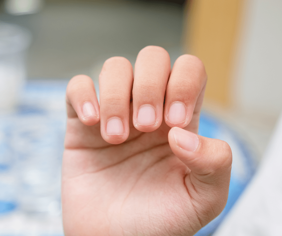 alteracions de les ungles